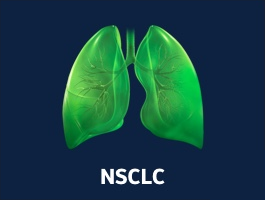 nsclc